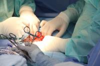 Ler notícia: SNS realizou em 2022 o maior número de sempre de cirurgias oncológicas