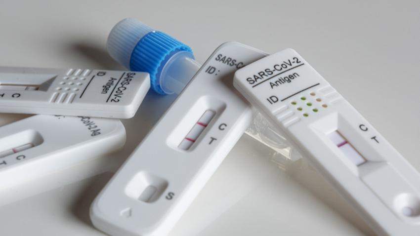 Testes rápidos de antigénio de uso profissional continuam gratuitos em fevereiro